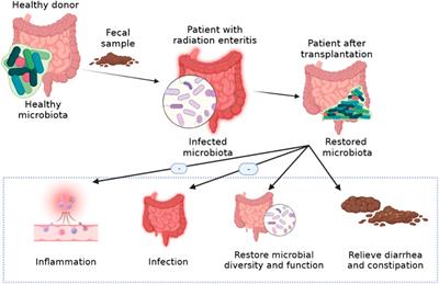 Frontiers Pathogenesis and therapy of radiation enteritis with